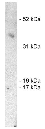 Rabbit Human SIAH1, E3 Ubiquitin Ligase Antibody