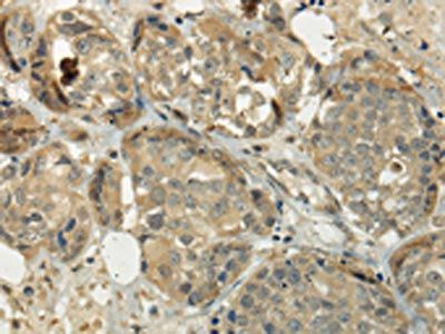 SIAH1 Antibody