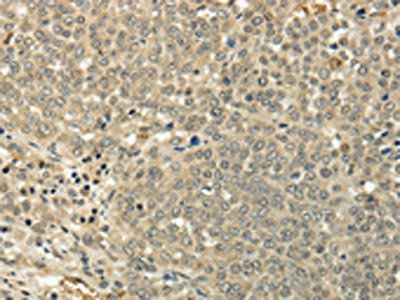 SIAH1 Antibody