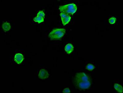SIAH2 Antibody