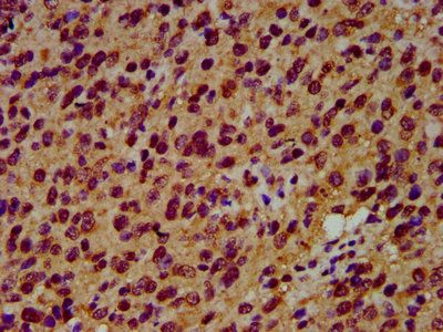 SIAH2 Antibody