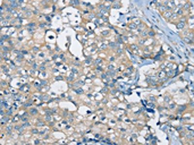 SIAH2 Antibody