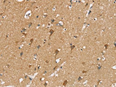 SIAH2 Antibody