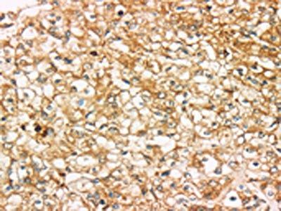 SIGLEC15 Antibody