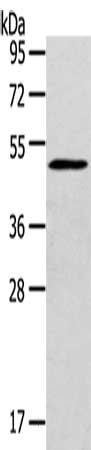 SIGLEC15 Antibody