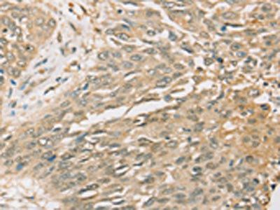 SIGLEC15 Antibody