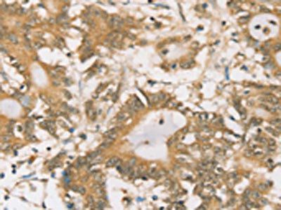 SIGLEC15 Antibody