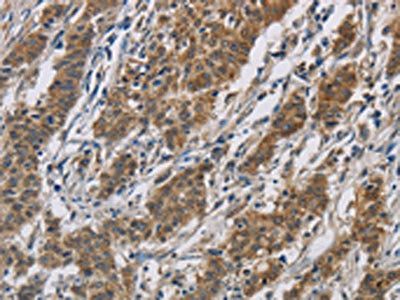 SIGMAR1 Antibody
