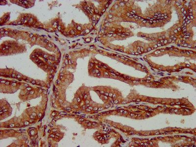 SLC14A1 Antibody