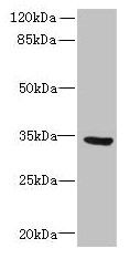 SLC25A18 Antibody