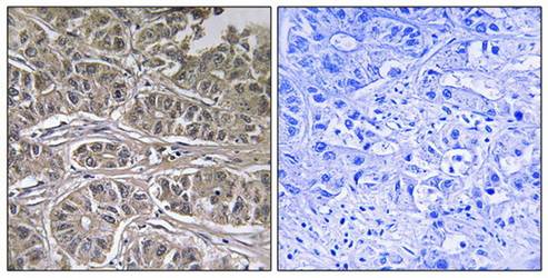 SLC25A21 Antibody