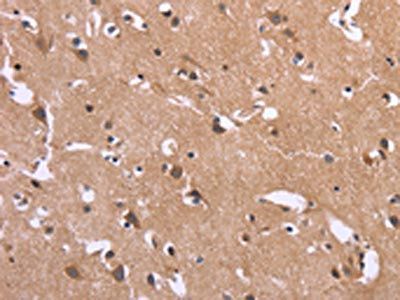 SLC52A1 Antibody