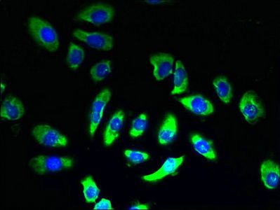 SLC5A2 Antibody