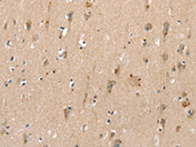 SLC6A8 Antibody