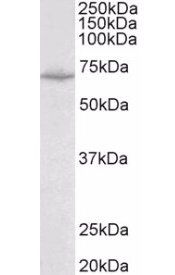 Creatine transporter 1/SLC6A8 Antibody