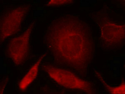 SMAD3 Antibody