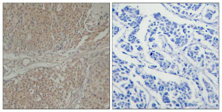 SMAD3 Antibody