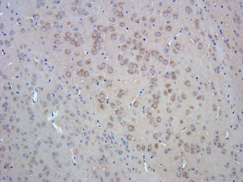Smad7 Rabbit Polyclonal Antibody