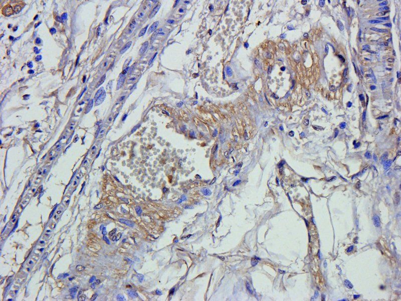 Smad7 Rabbit Polyclonal Antibody
