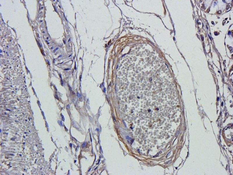 Smad7 Rabbit Polyclonal Antibody