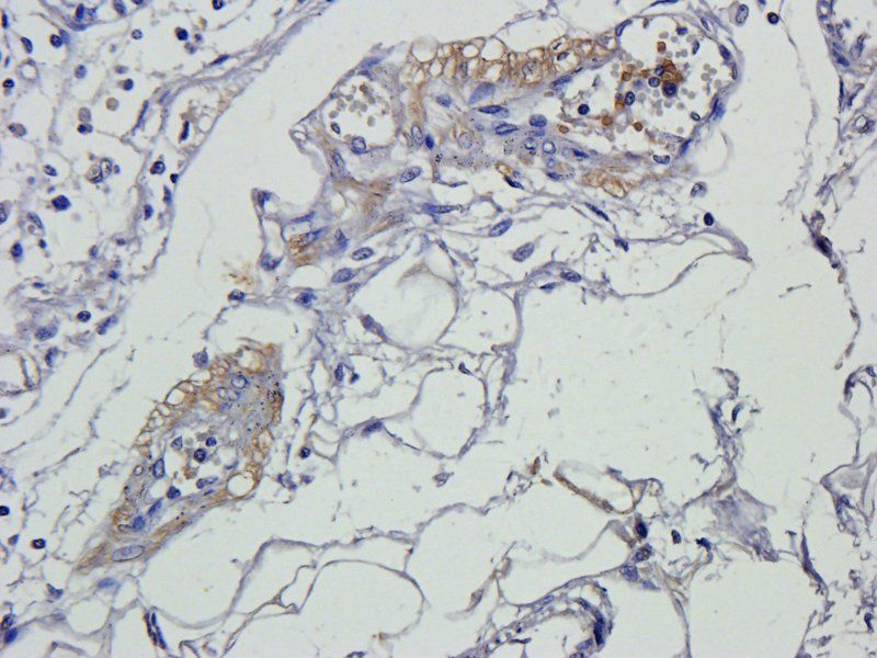Smad7 Rabbit Polyclonal Antibody