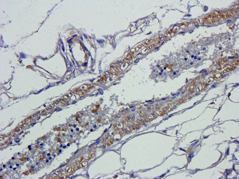 Smad7 Rabbit Polyclonal Antibody