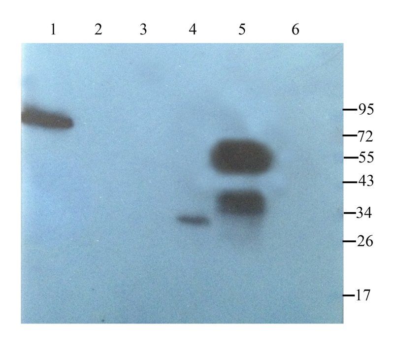 Smad7 Rabbit Polyclonal Antibody