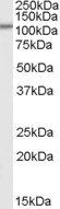 SMEK1/KIAA2010 Antibody