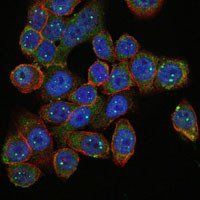 SMN1 Antibody