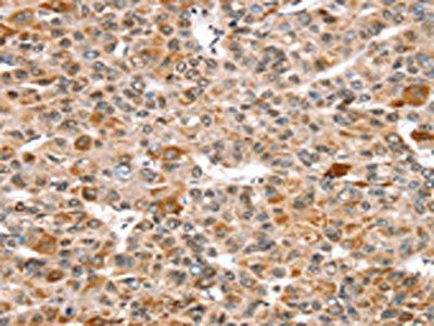 SNX15 Antibody