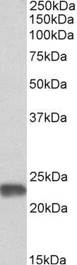 MNSOD (isoform A) Antibody