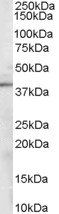 Sorbitol Dehydrogenase Antibody