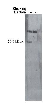 Rabbit Human Sphingosine 1-Phosphate Lyase 1 Antibody