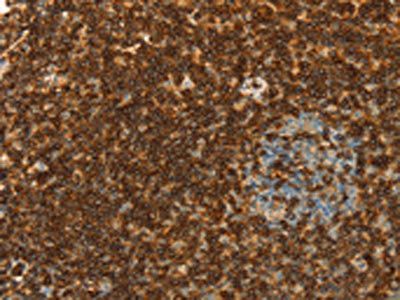 SPN Antibody