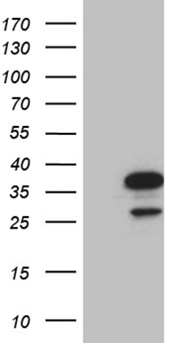 SUPT3H Antibody