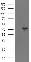 SQSTM1 Antibody
