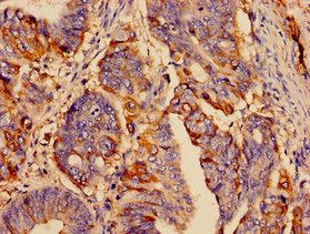 SST Antibody