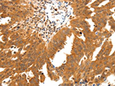 SSTR2 Antibody