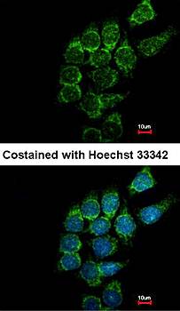 ST3GAL1 antibody