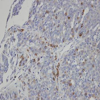 ST3GAL1 antibody