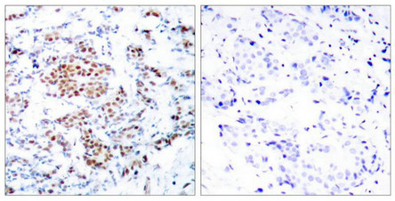 STAT5A Antibody