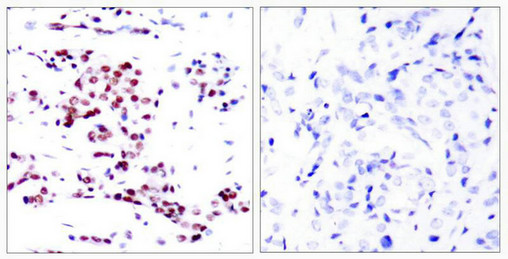 STAT5A Antibody