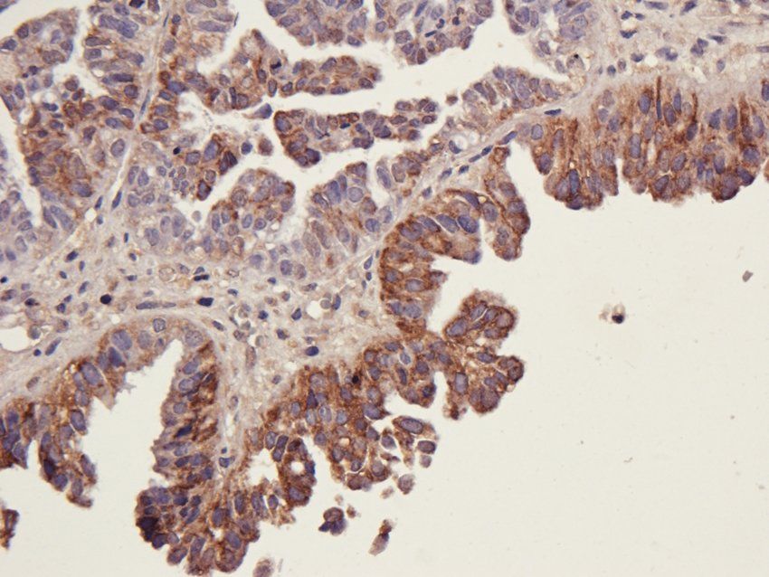STAT5B Rabbit Polyclonal Antibody