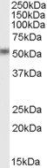 STEAP4/Dudulin4 Antibody