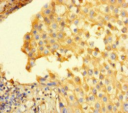 STIL Antibody