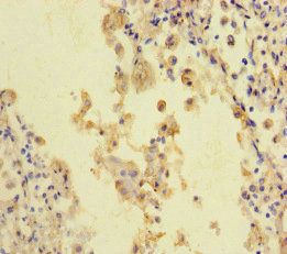 STIL Antibody