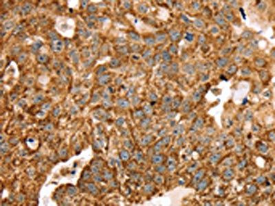 STK32B Antibody