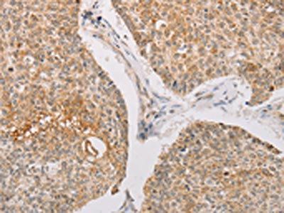 STK40 Antibody