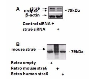 Goat anti-STRA6 (mouse, rat) Antibody