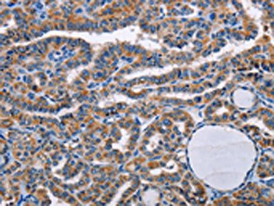 STRADB Antibody